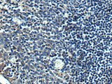 Immunohistochemistry of paraffin-embedded Human tonsil tissue using PRRT2 Polyclonal Antibody at dilution of 1:40(×200)
