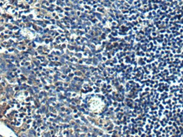 Anti-Human/Mouse/Rat PRRT2 Antibody