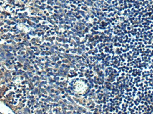 Anti-Human/Mouse/Rat PRRT2 Antibody
