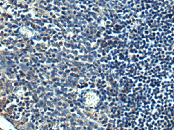 Immunohistochemistry of paraffin-embedded Human tonsil tissue using PRRT2 Polyclonal Antibody at dilution of 1:40(×200)