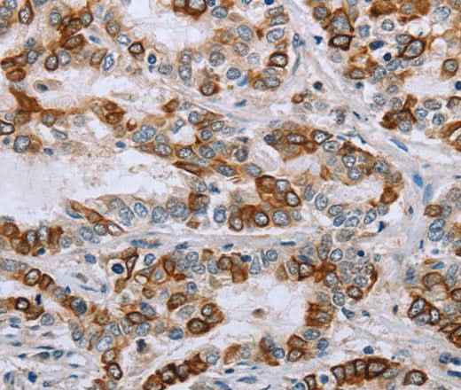 Anti-Human/Mouse/Rat NMT1 Antibody