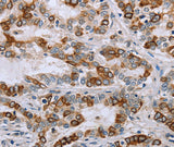 Anti-Human/Mouse/Rat NMT1 Antibody - ABMIUM