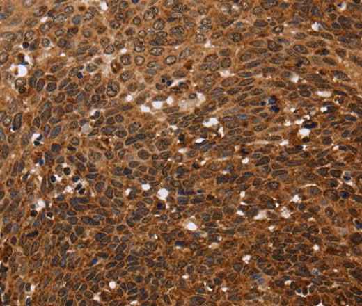 Anti-Human FANCF Antibody