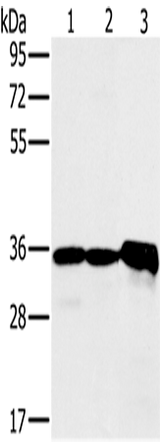 Anti-Human/Mouse NDUFA9 Antibody - ABMIUM
