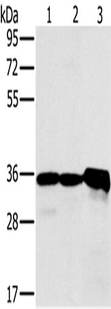 Anti-Human/Mouse NDUFA9 Antibody - ABMIUM