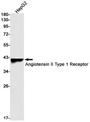 Western blot detection of Angiotensin II Type 1 Receptor in HepG2 cell lysates using Angiotensin II Type 1 Receptor Rabbit mAb(1:1000 diluted).Predicted band size:41kDa.Observed band size:41kDa.