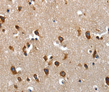 Anti-Human LAMA1 Antibody - ABMIUM