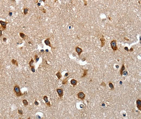 Anti-Human LAMA1 Antibody - ABMIUM