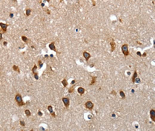 Anti-Human LAMA1 Antibody - ABMIUM
