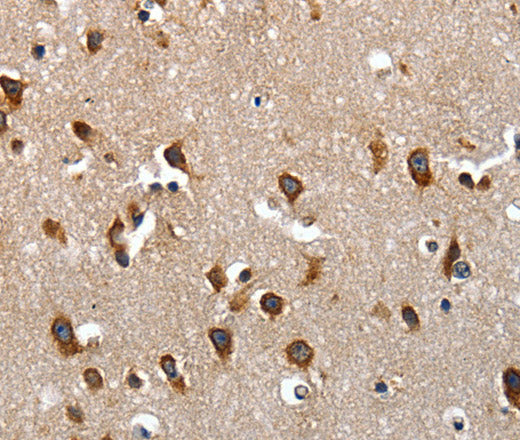 Anti-Human LAMA1 Antibody - ABMIUM