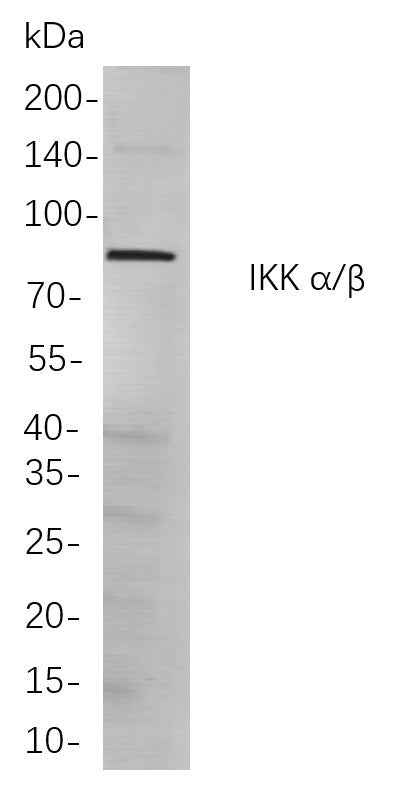 Anti-Human/Mouse/Rat IKK α/β Antibody [B871] - ABMIUM