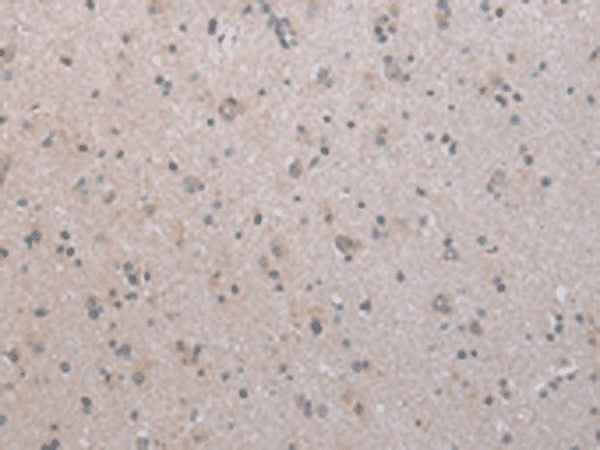 Anti-Human/Mouse COX17 Antibody