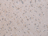 Immunohistochemistry of paraffin-embedded Human brain tissue using COX17 Polyclonal Antibody at dilution of 1:45(×200)