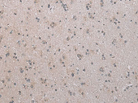 Immunohistochemistry of paraffin-embedded Human brain tissue using COX17 Polyclonal Antibody at dilution of 1:45(×200)
