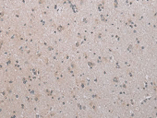 Immunohistochemistry of paraffin-embedded Human brain tissue using COX17 Polyclonal Antibody at dilution of 1:45(×200)
