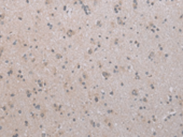 Immunohistochemistry of paraffin-embedded Human brain tissue using COX17 Polyclonal Antibody at dilution of 1:45(×200)