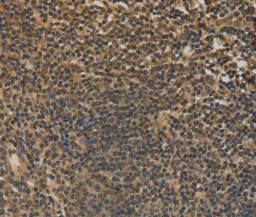 Anti-Human/Mouse DACH1 Antibody
