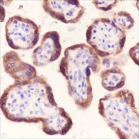 Anti-Human/Mouse Laminin beta 1 Antibody [A284] - ABMIUM