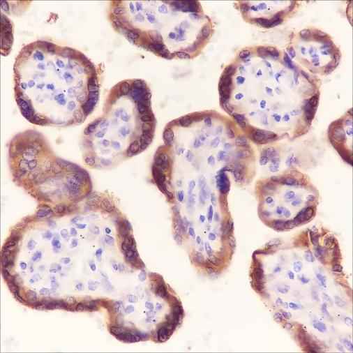 Anti-Human/Mouse Laminin beta 1 Antibody [A284] - ABMIUM
