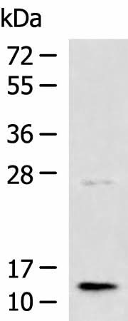 Western blot analysis of Human liver tissue lysate using TMEM141 Polyclonal Antibody at dilution of 1:1000