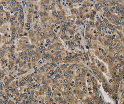Anti-Human/Mouse/Rat KCNMB2 Antibody - ABMIUM