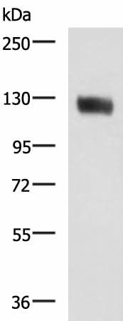 Western blot analysis of Human leiomyosarcoma tissue lysate using MCAM Polyclonal Antibody at dilution of 1:400