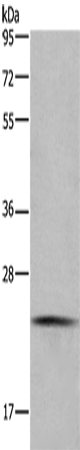 Anti-Human CMTM6 Antibody - ABMIUM