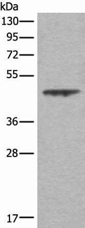 Anti-Human/Mouse/Rat ASS1 Antibody
