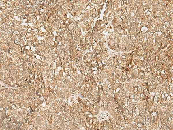 Anti-Human/Mouse SNAPC5 Antibody