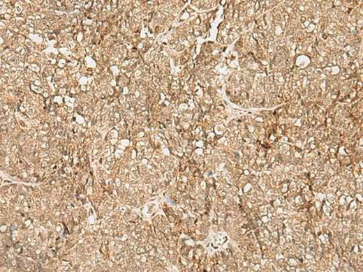 Anti-Human/Mouse SNAPC5 Antibody