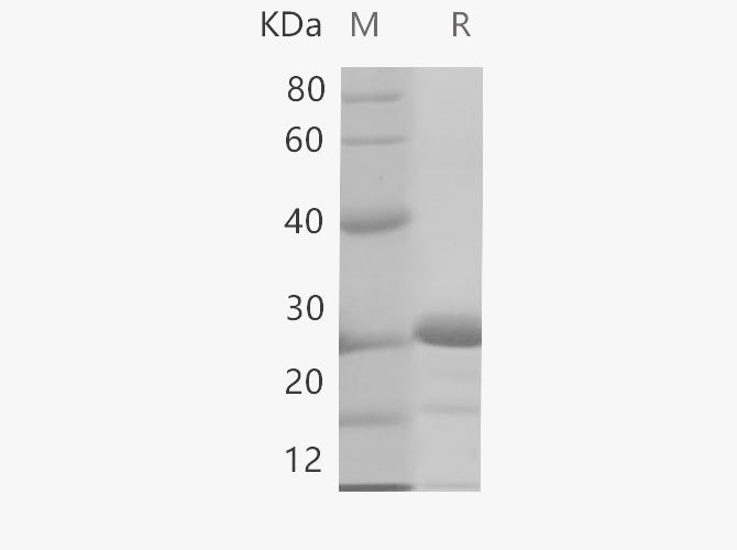 SDS-PAGE analysis of Human BRCA2 proteins, 2 μg/lane of Recombinant Human BRCA2 proteins was resolved with SDS-PAGE under reducing conditions, showing bands at 25.4 kDa.