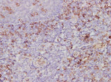 Anti-Human CXCL2/GRO beta Antibody - ABMIUM