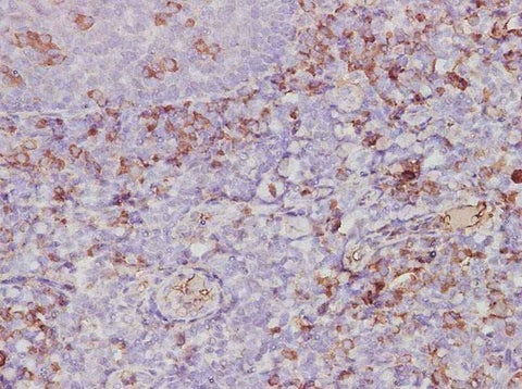 Anti-Human CXCL2/GRO beta Antibody - ABMIUM