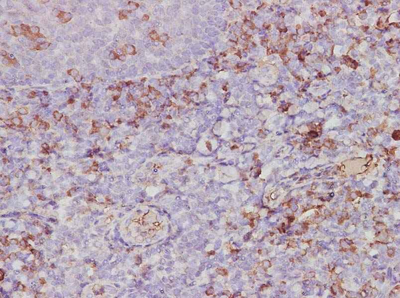 Anti-Human CXCL2/GRO beta Antibody - ABMIUM
