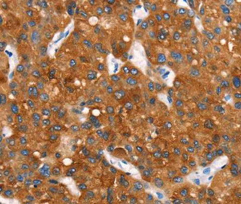 Anti-Human Cytochrome b Antibody