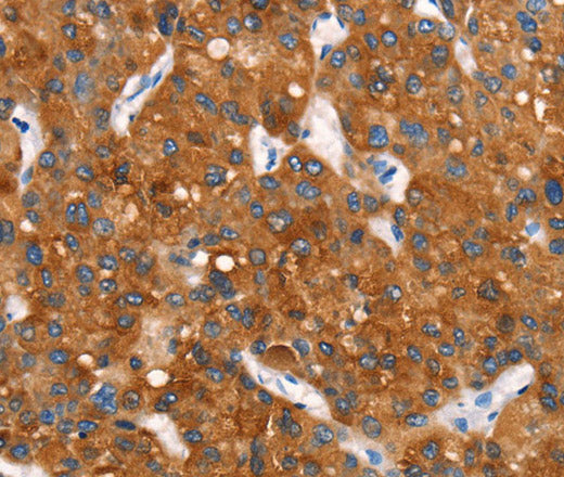 Anti-Human Cytochrome b Antibody - ABMIUM