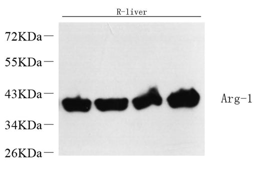 Western Blot analysis of various samples using ARG1 Polyclonal Antibody at dilution of 1:10000.