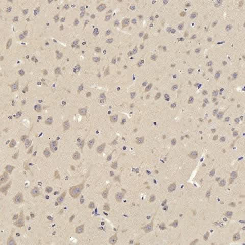Immunohistochemistry analysis of paraffin-embedded rat cortex using TAC1 Polyclonal Antibody at dilution of 1:300.