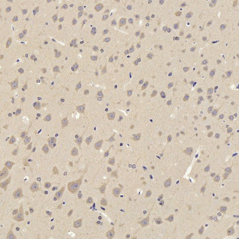 Immunohistochemistry analysis of paraffin-embedded rat cortex using TAC1 Polyclonal Antibody at dilution of 1:300.