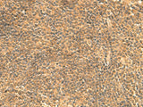 Immunohistochemistry of paraffin-embedded Human tonsil tissue using FAM186B Polyclonal Antibody at dilution of 1:25(×200)
