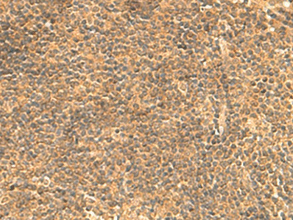Immunohistochemistry of paraffin-embedded Human tonsil tissue using FAM186B Polyclonal Antibody at dilution of 1:25(×200)
