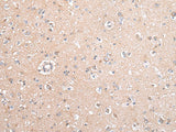 Anti-Human/Mouse/Rat GJB5 Antibody - ABMIUM