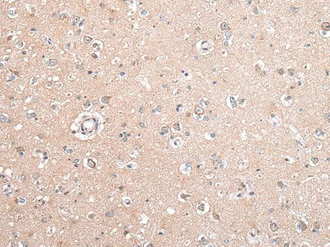 Anti-Human/Mouse/Rat GJB5 Antibody - ABMIUM