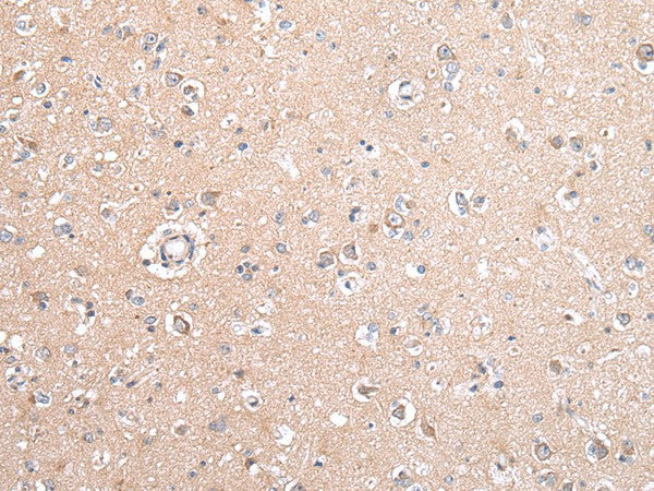 Anti-Human/Mouse/Rat GJB5 Antibody - ABMIUM
