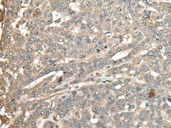 Anti-Human ATXN3 Antibody