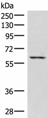 Western blot analysis of K562 cell lysate using JRKL Polyclonal Antibody at dilution of 1:1000