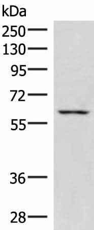 Anti-Human/Mouse JRKL Antibody