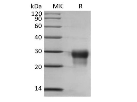 Recombinant Human Placenta Growth Factor/PGF/PIGF/PLGF (C-6His) - ABMIUM