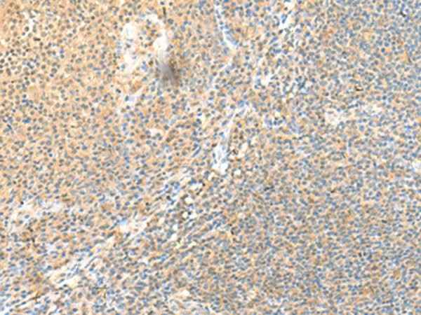 Anti-Human SSC4D Antibody