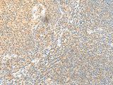 Immunohistochemistry of paraffin-embedded Human tonsil tissue using SSC4D Polyclonal Antibody at dilution of 1:70(×200)